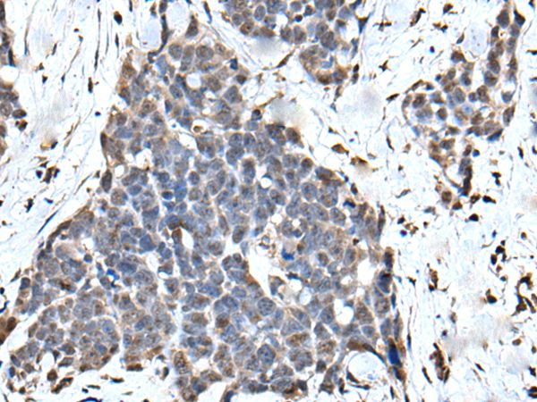 ATF6B Antibody