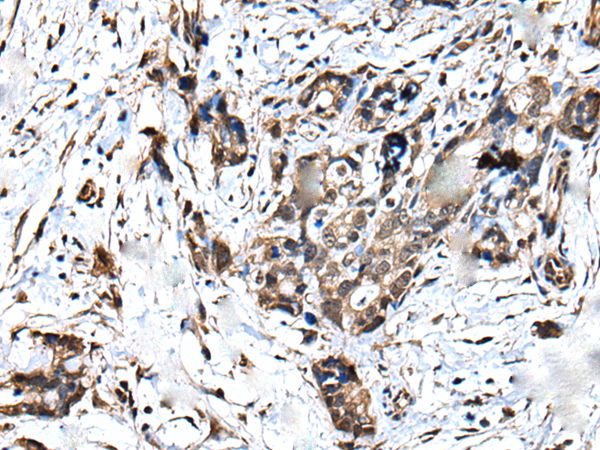 ATF6B Antibody