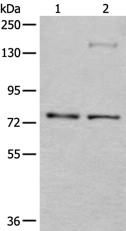 ATF6B Antibody