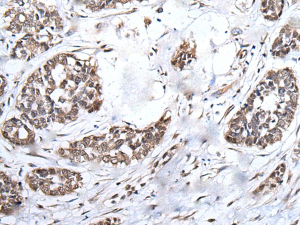 BRMS1L Antibody