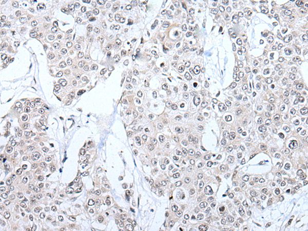 BRMS1L Antibody