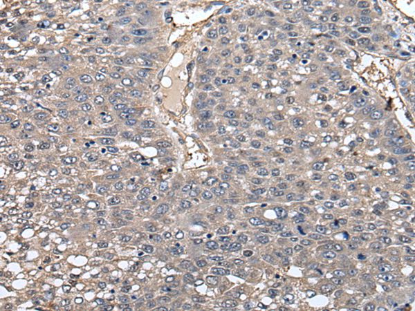 GCNT2 Antibody