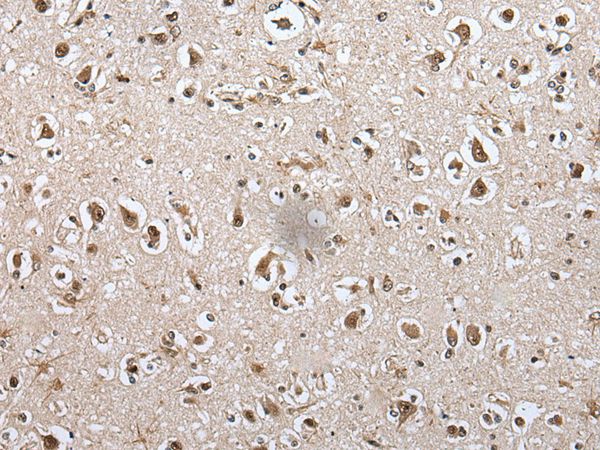METAP1D Antibody