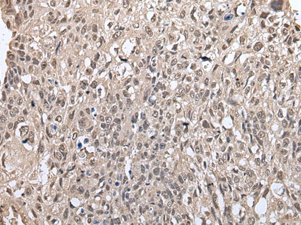 METAP1D Antibody
