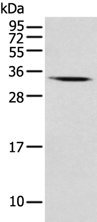 USE1 Antibody