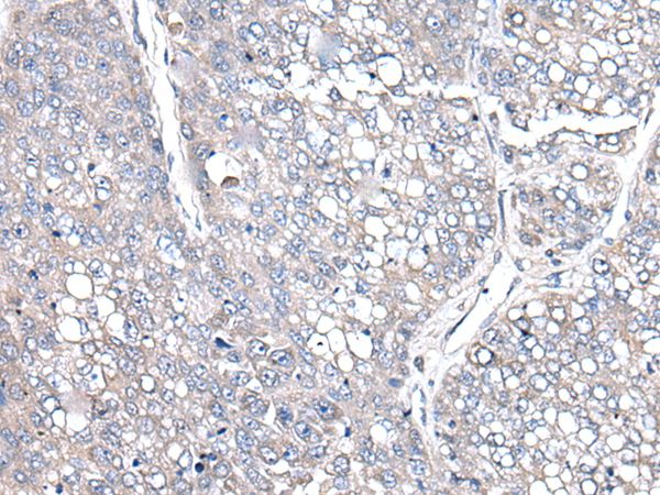 COMMD10 Antibody