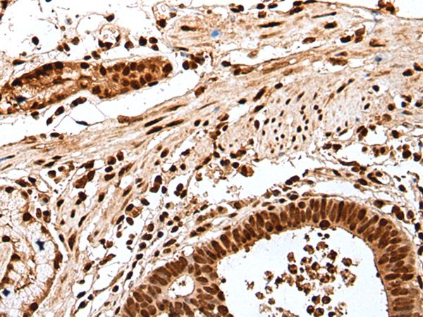 GAR1 Antibody