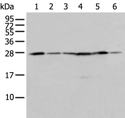 FKBP7 Antibody