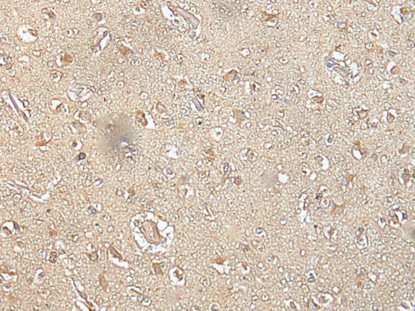 SPIC Antibody