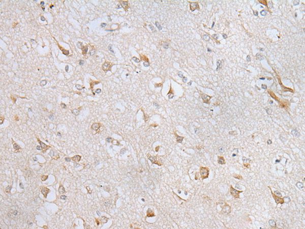RPL8 Antibody