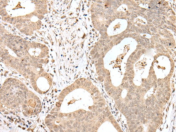 SNF8 Antibody