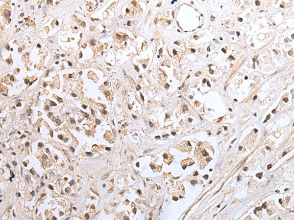 SNF8 Antibody
