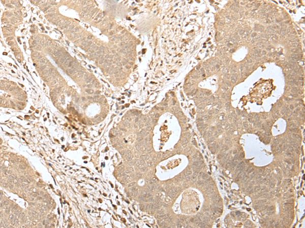 HDHD2 Antibody