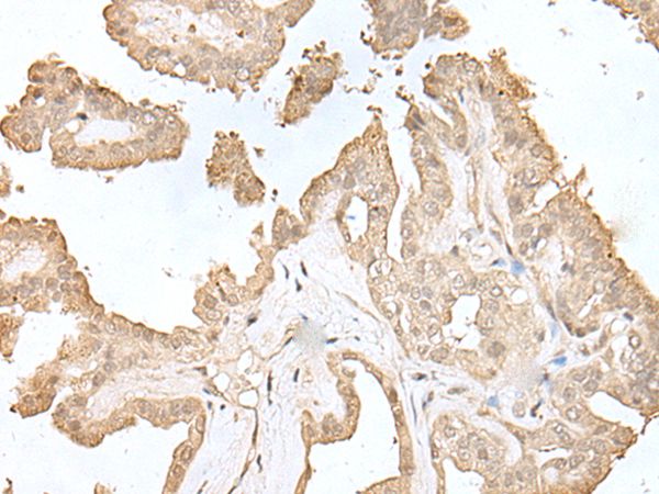 HDHD2 Antibody
