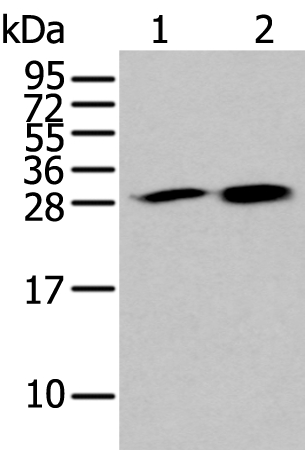 HDHD2 Antibody