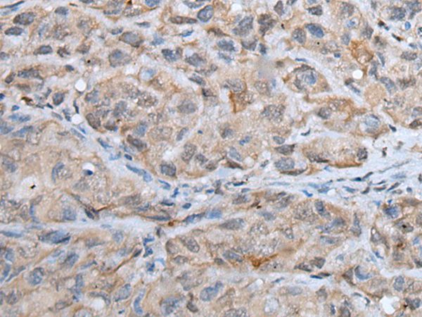 DPM1 Antibody