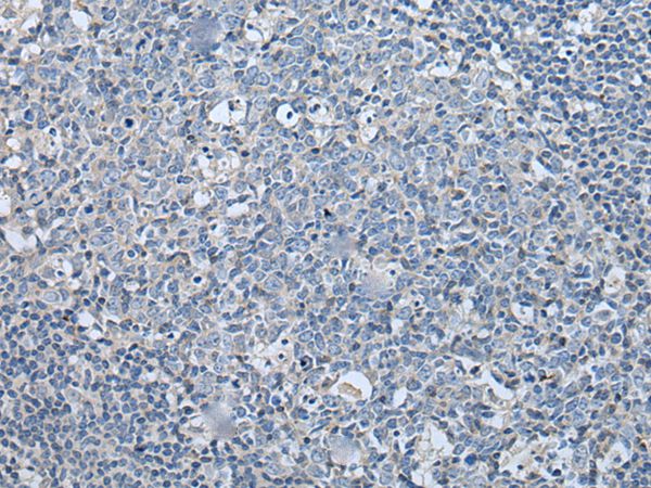 LASP1 Antibody