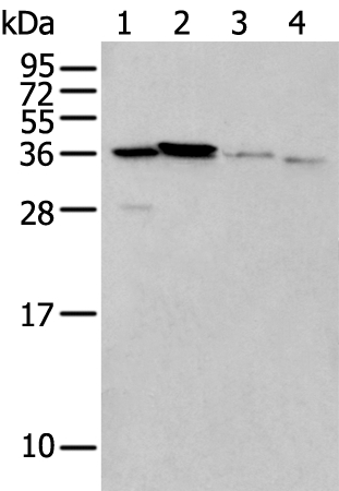 LASP1 Antibody