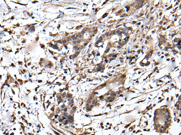 ZFP36 Antibody