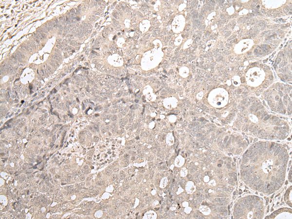 ZNF138 Antibody
