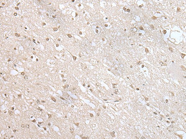 ZNF138 Antibody