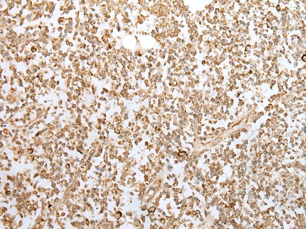 ZKSCAN1 Antibody