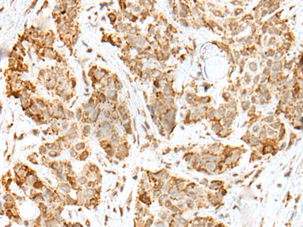 ZKSCAN1 Antibody