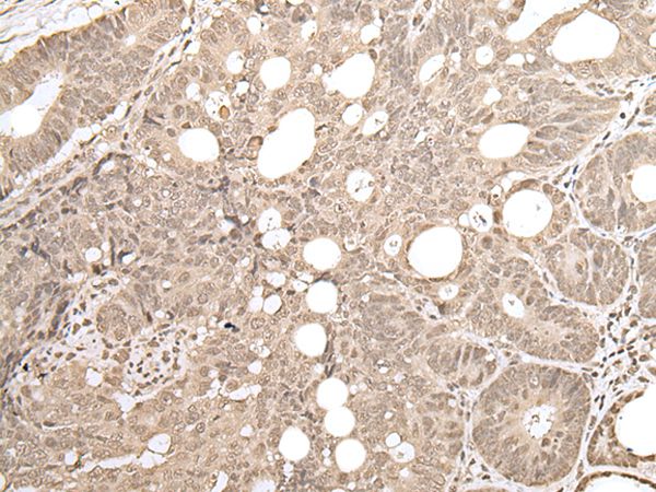 ZKSCAN3 Antibody