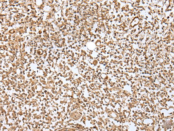 ZMAT2 Antibody