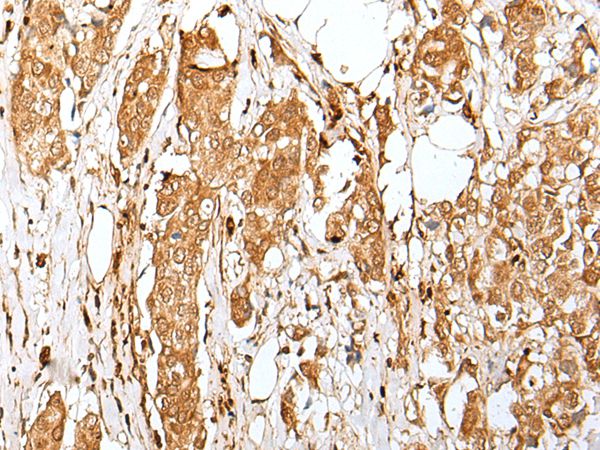 ZMAT2 Antibody