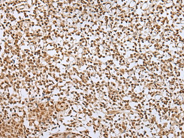 ZNF354A Antibody