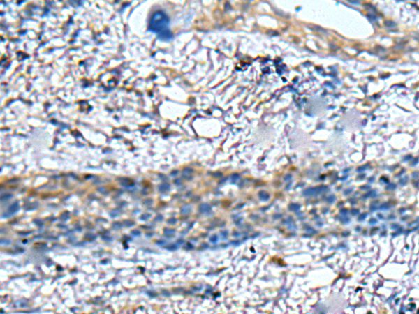 ZNF512 Antibody
