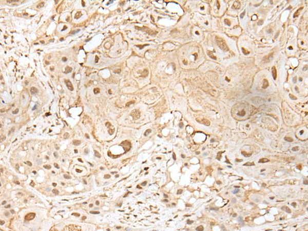 ZZZ3 Antibody