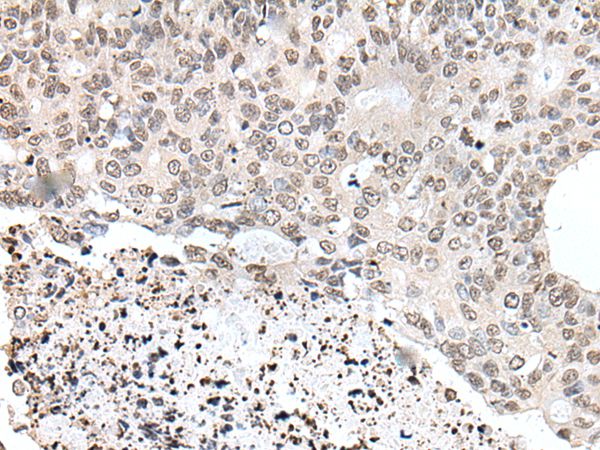 YPEL1 Antibody