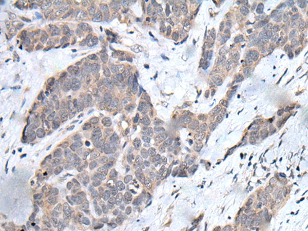 YPEL3 Antibody