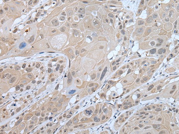 WFS1 Antibody