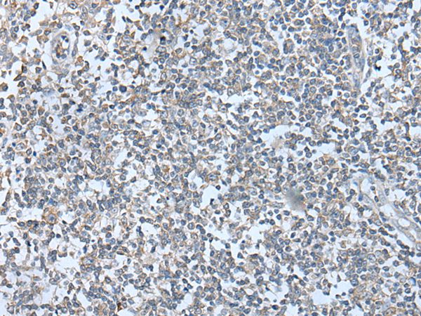 WFS1 Antibody
