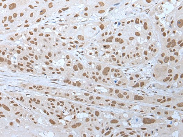 NELFA Antibody