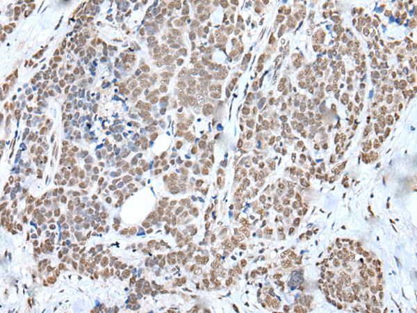 WTAP Antibody