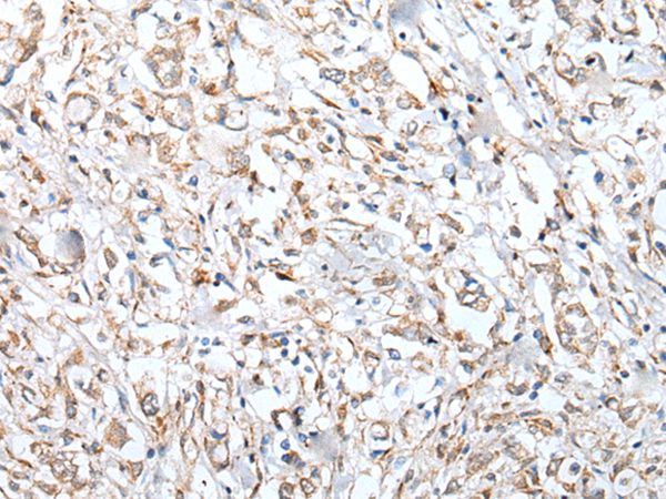 VPREB3 Antibody