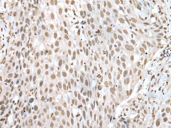 VSX1 Antibody