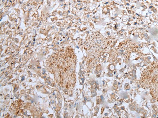UBA6 Antibody