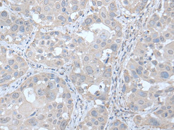 UBE2Q2 Antibody