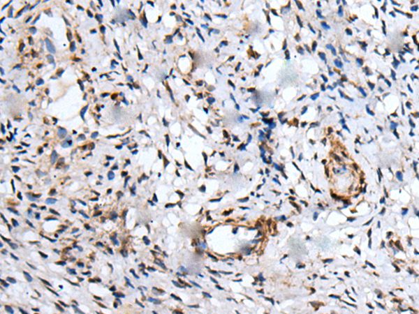 UBE2W Antibody