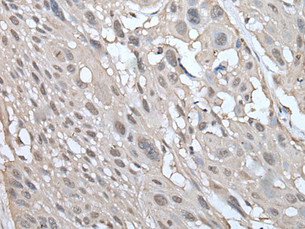 UBE2W Antibody