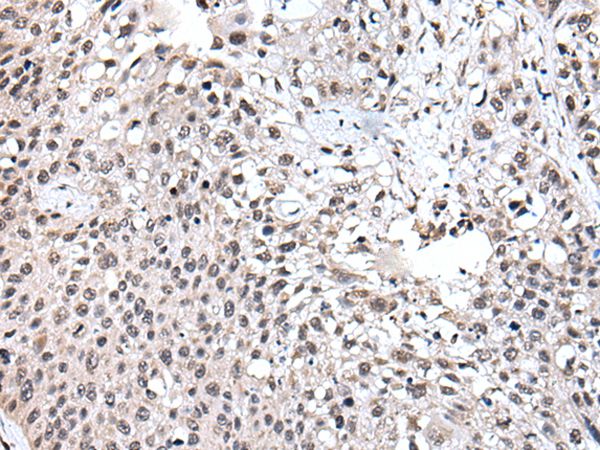 UBE2E3 Antibody