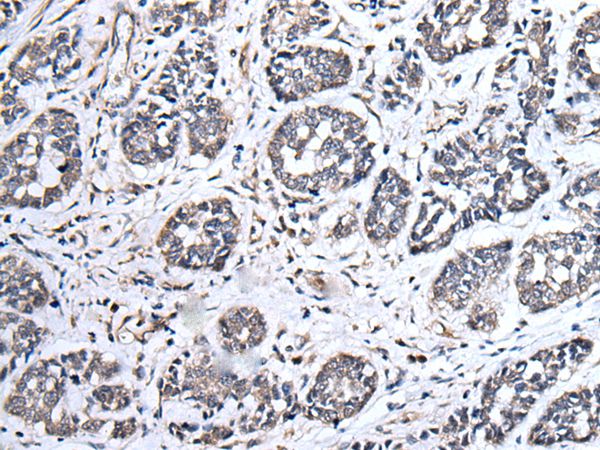 UBE2E3 Antibody