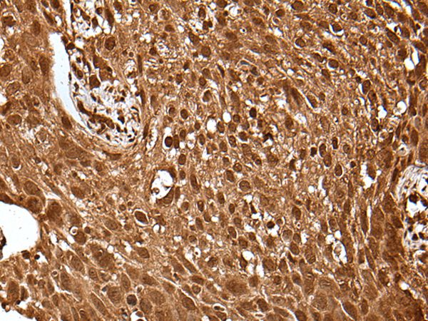UBE4A Antibody