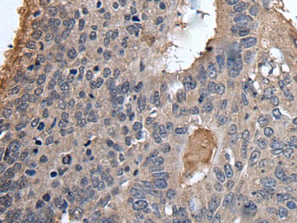 UBR2 Antibody
