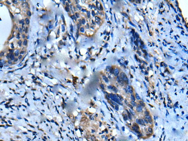 UFC1 Antibody